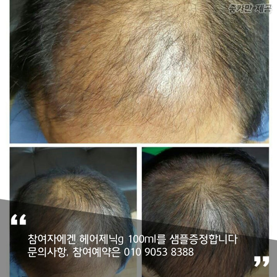 브니엘 헤어 이미지