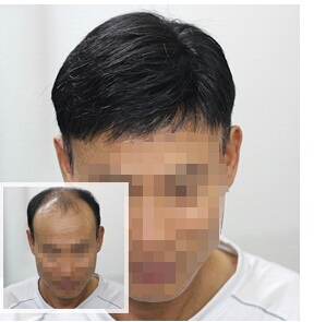 심는가발 이미지