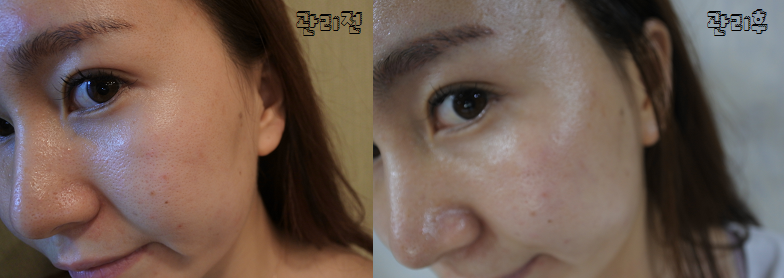 청담스킨타운 이미지