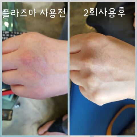 박피부미용실 이미지