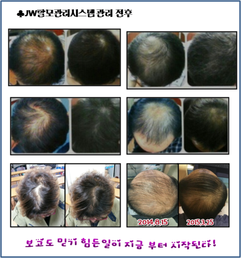 JW 헤어 이미지