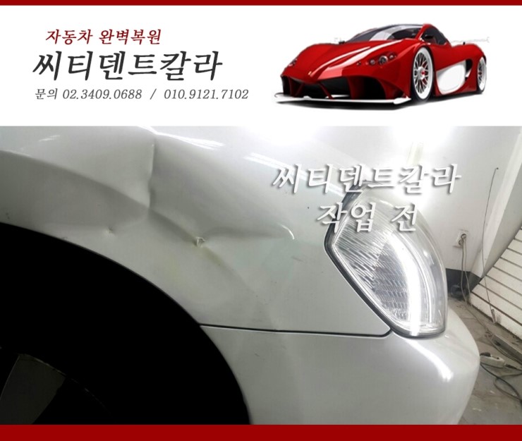씨티덴트 이미지