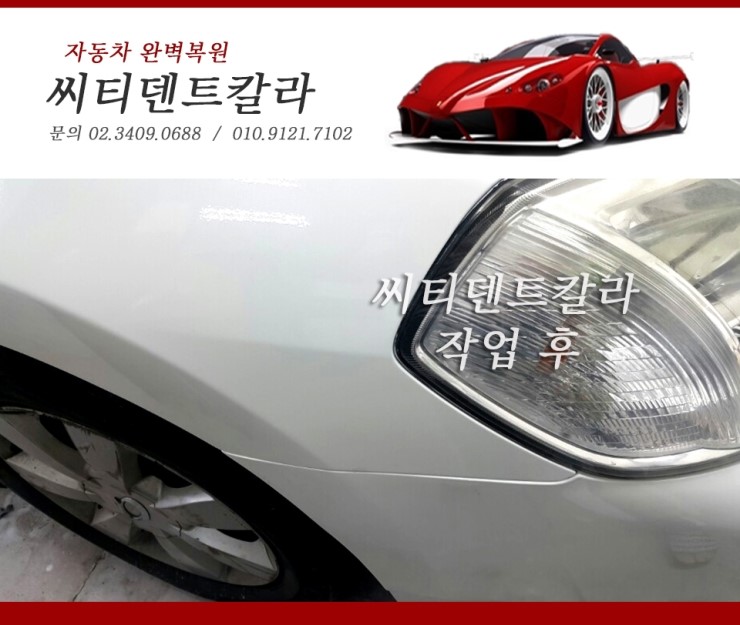 씨티덴트 이미지