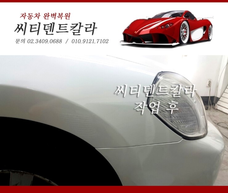 씨티덴트 이미지