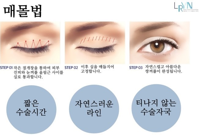 히트성형외과의원 이미지