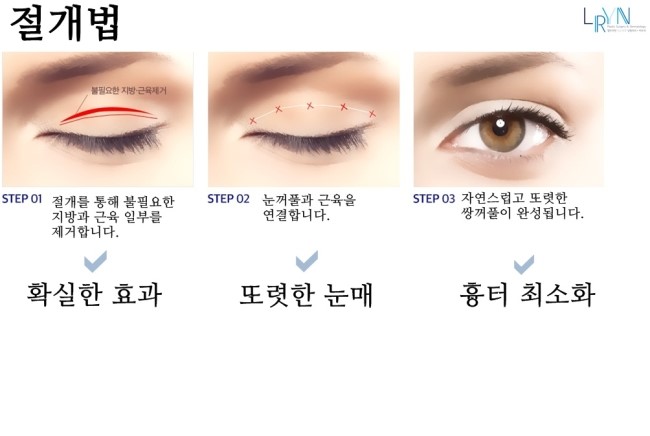 히트성형외과의원 이미지