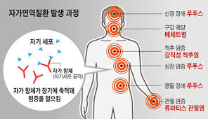 면역농부 이미지