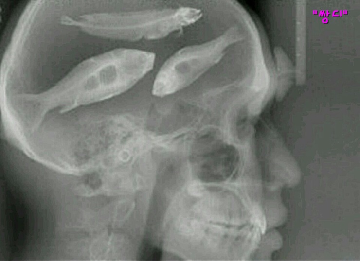 쌍디에 이미지