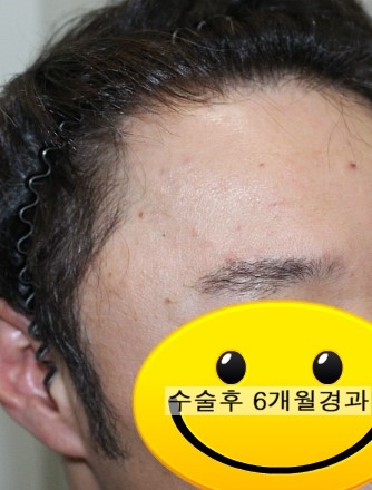 눈썹함다 이미지