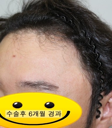 눈썹함다 이미지