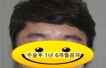 눈썹함다 이미지