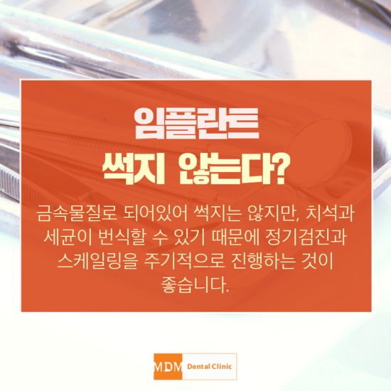 미드미가 이미지