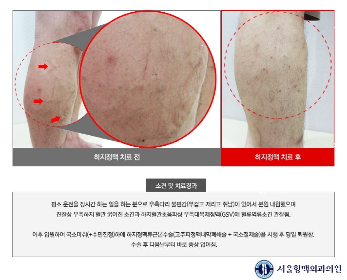 (합)경*류 이미지