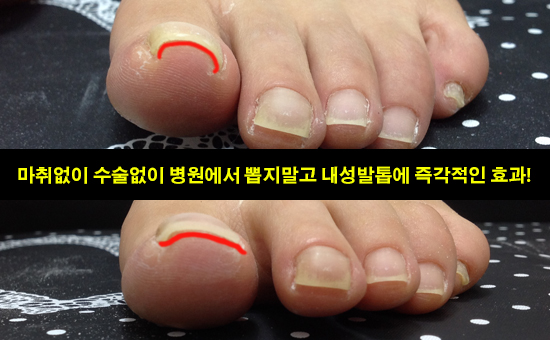 효니스터치 이미지