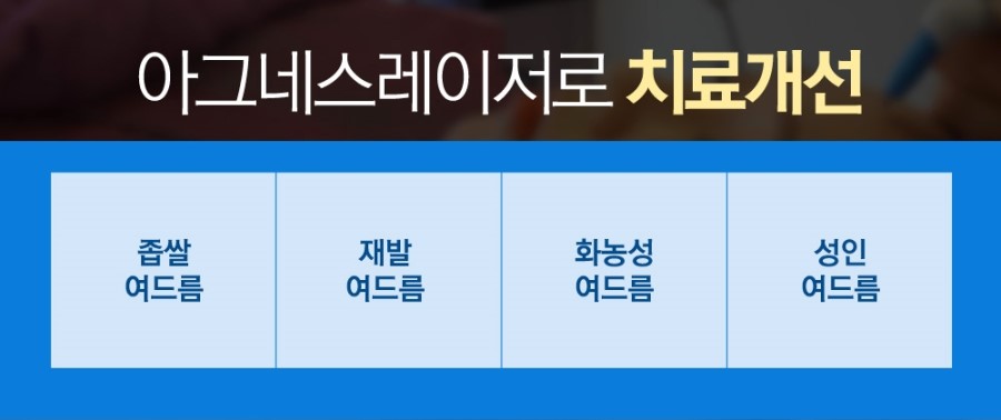 아그네스 이미지