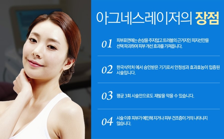아그네스 이미지