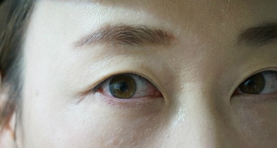 미스키니 이미지