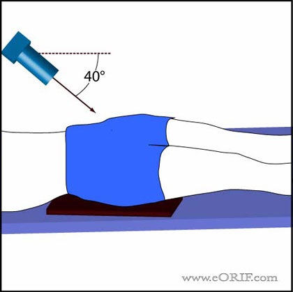 Pelvic X-ray의 Anatomy와 Positioning : 네이버 블로그
