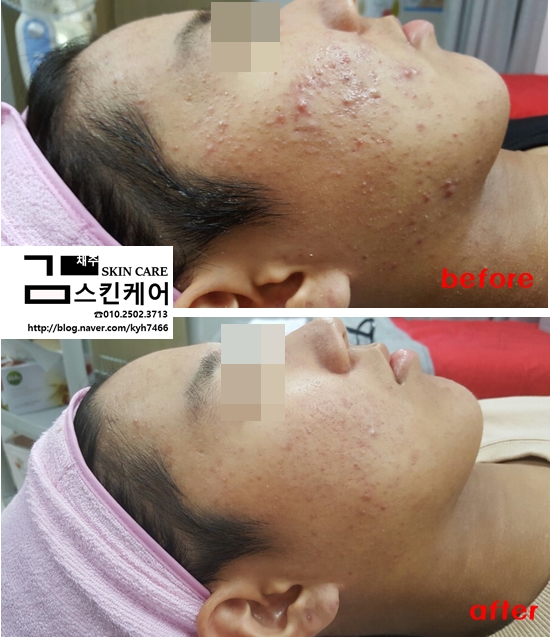 김채주스킨케어 이미지