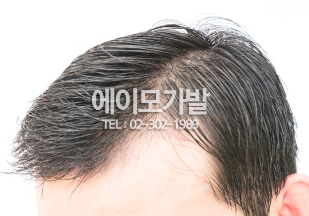 에이모가발 이미지