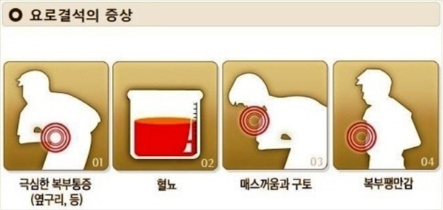 정한수비뇨기과 이미지