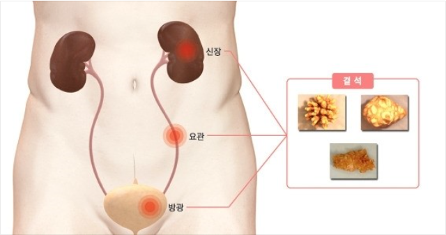 정한수비뇨기과 이미지