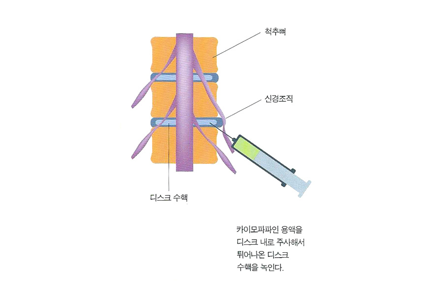 카이모 이미지