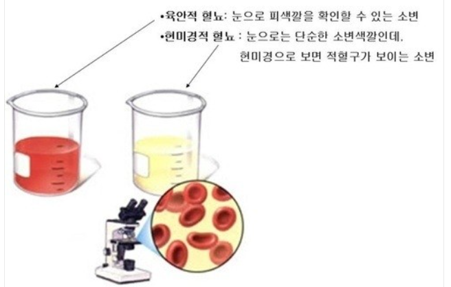 정한수비뇨기과 이미지