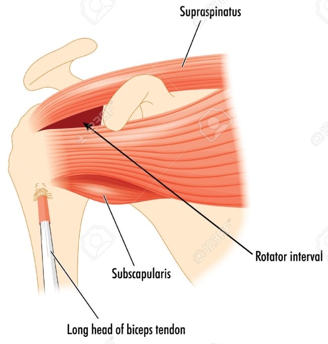 Rotator interval 네이버 블로그