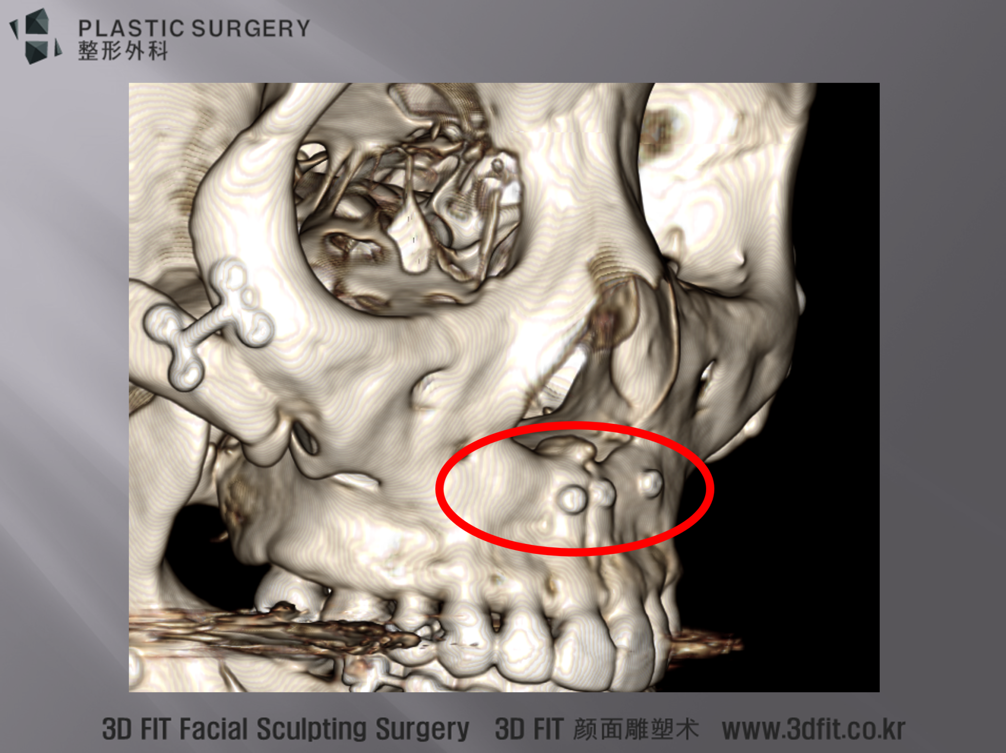 측면에서 보면