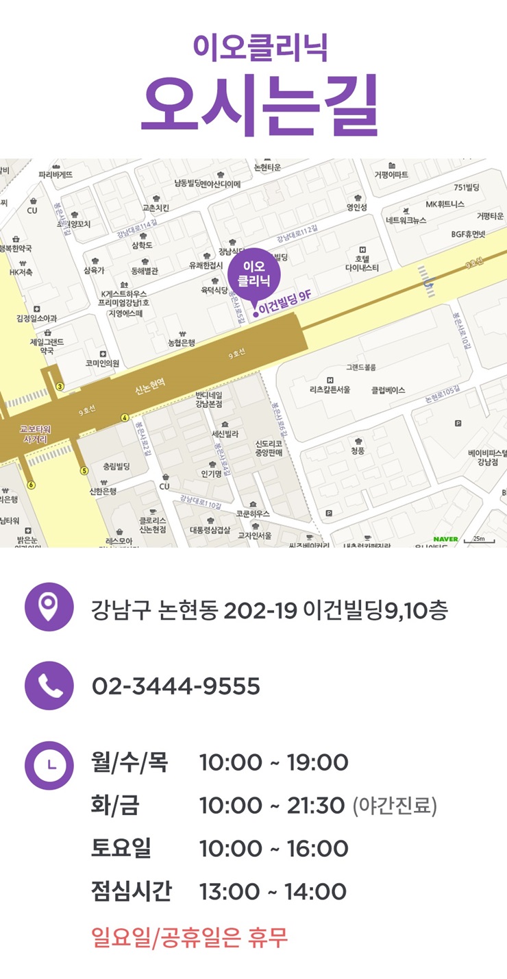 이오V 이미지