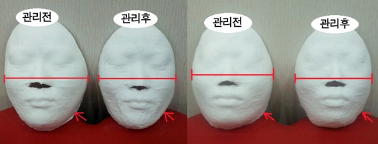 으뜸경락 이미지