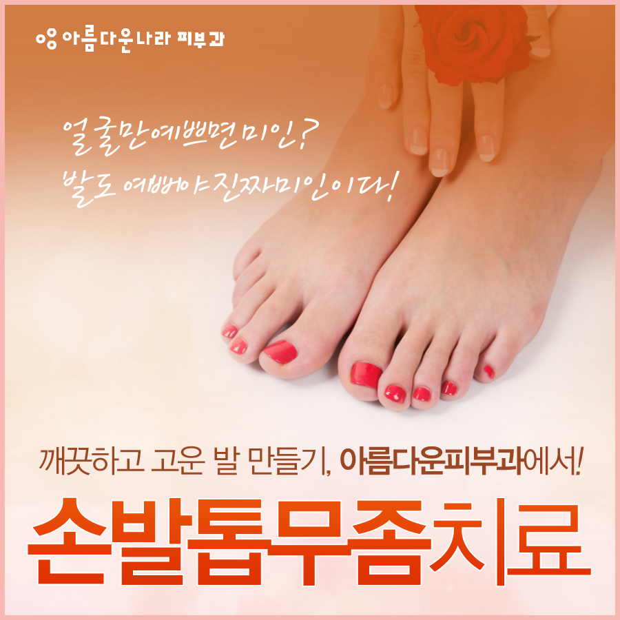 핀포인트 이미지