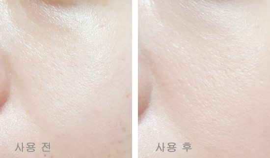 미가스킨케어 이미지