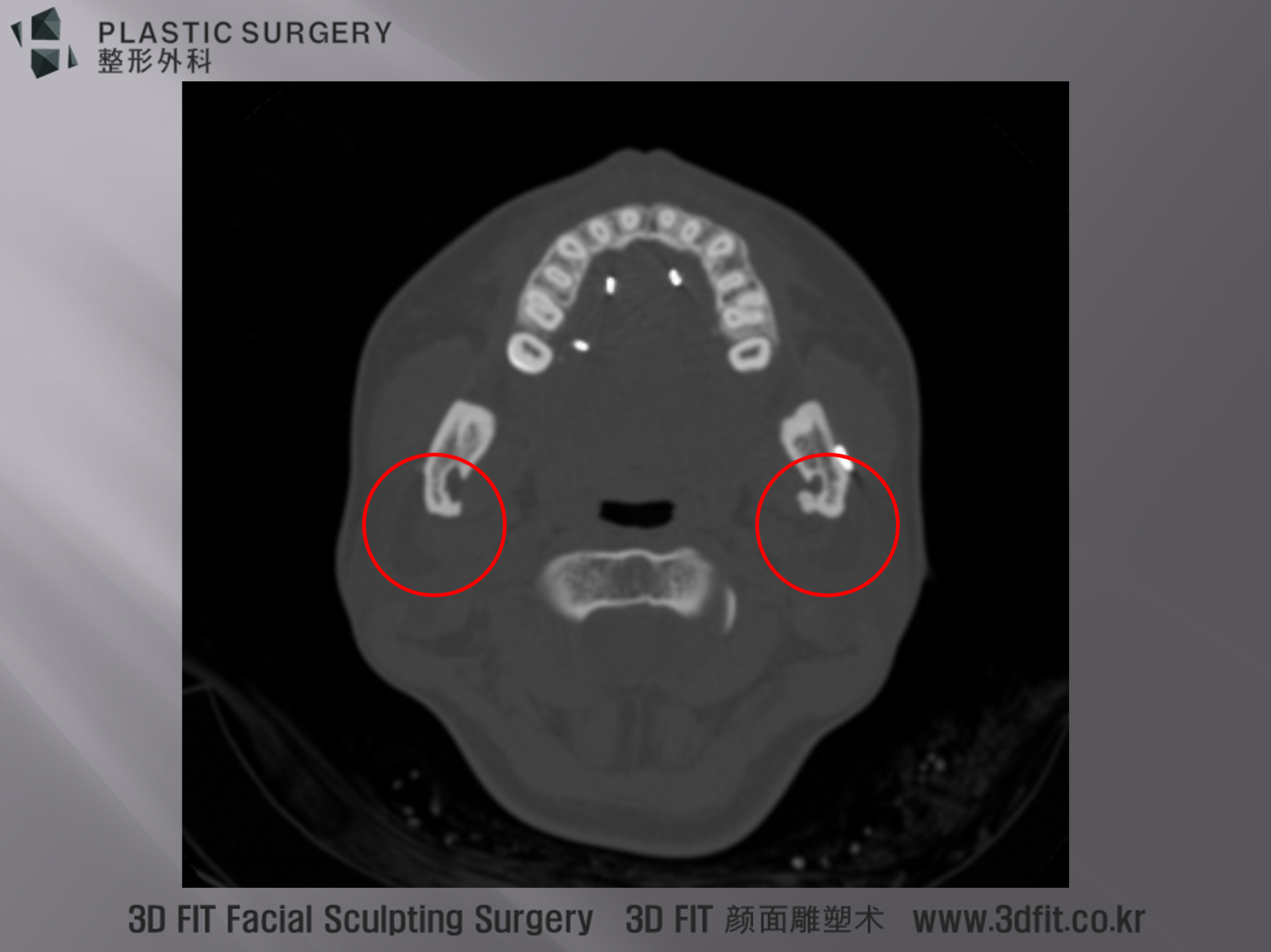 Axial 단면 이미지에서 