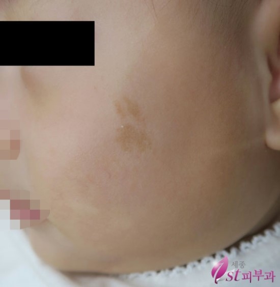 세종퍼스트피부과 이미지