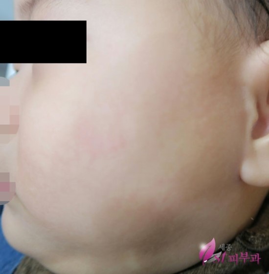 세종퍼스트피부과 이미지