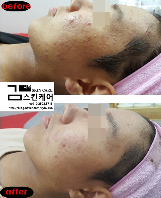 김채주스킨케어 이미지