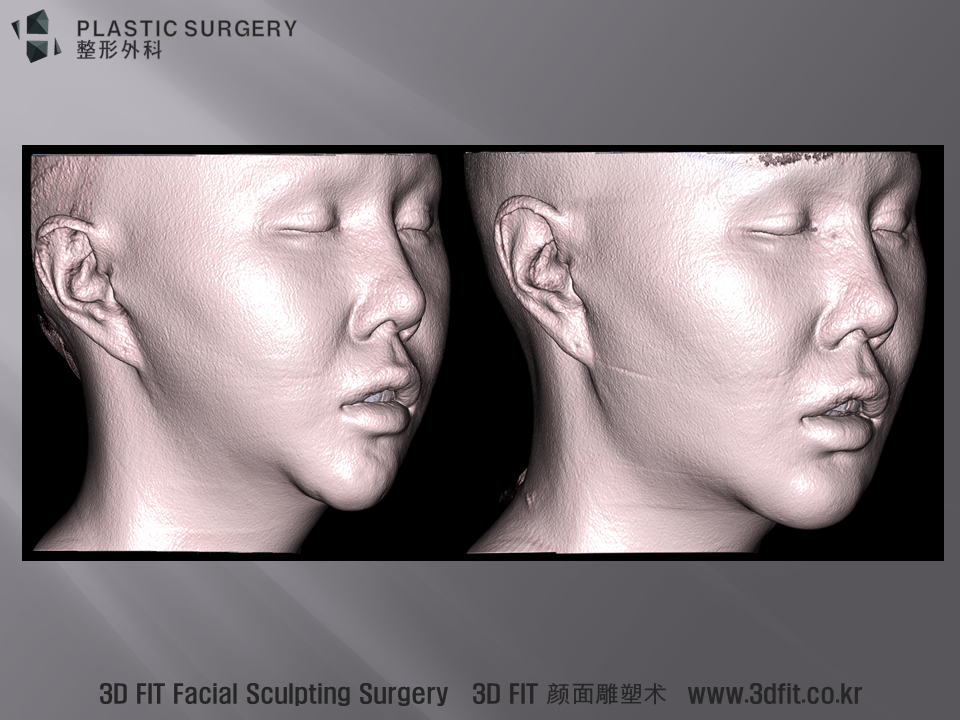우사면 모습에서도 