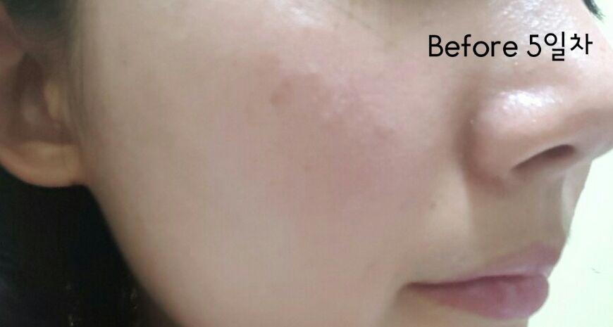 케이엔에이 이미지