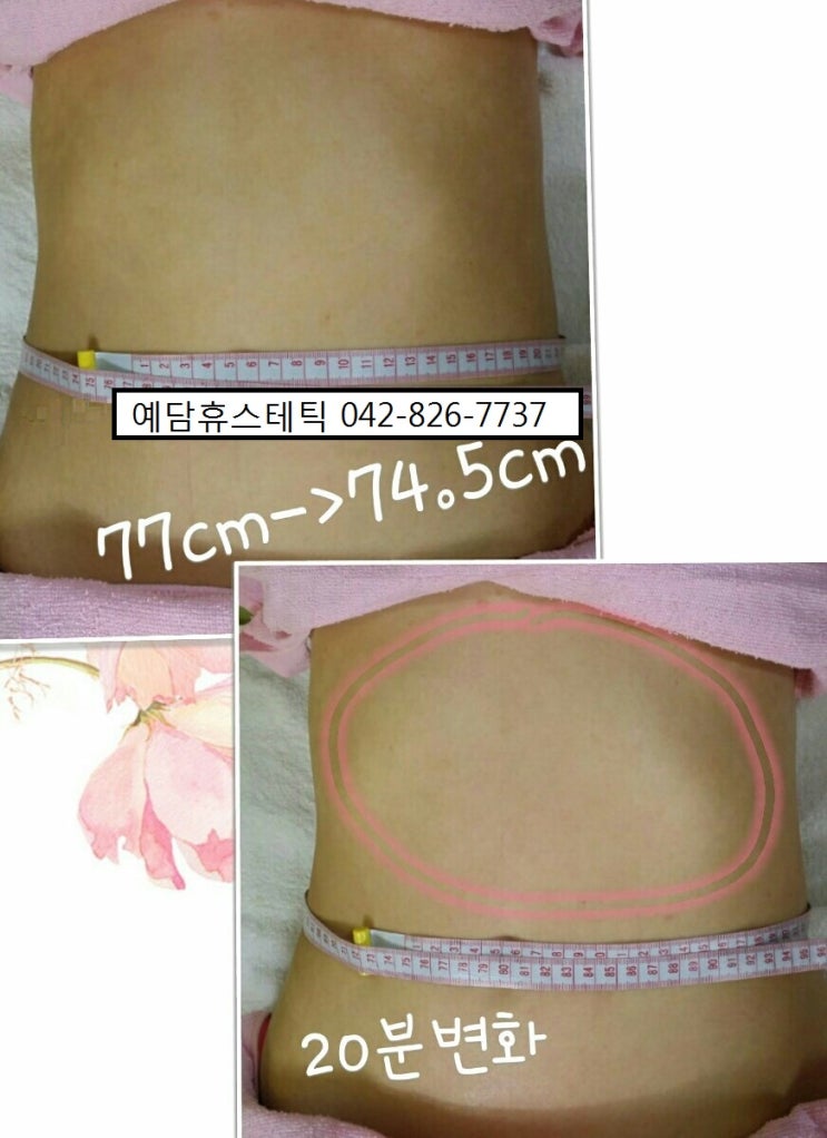 예담휴스테틱 이미지