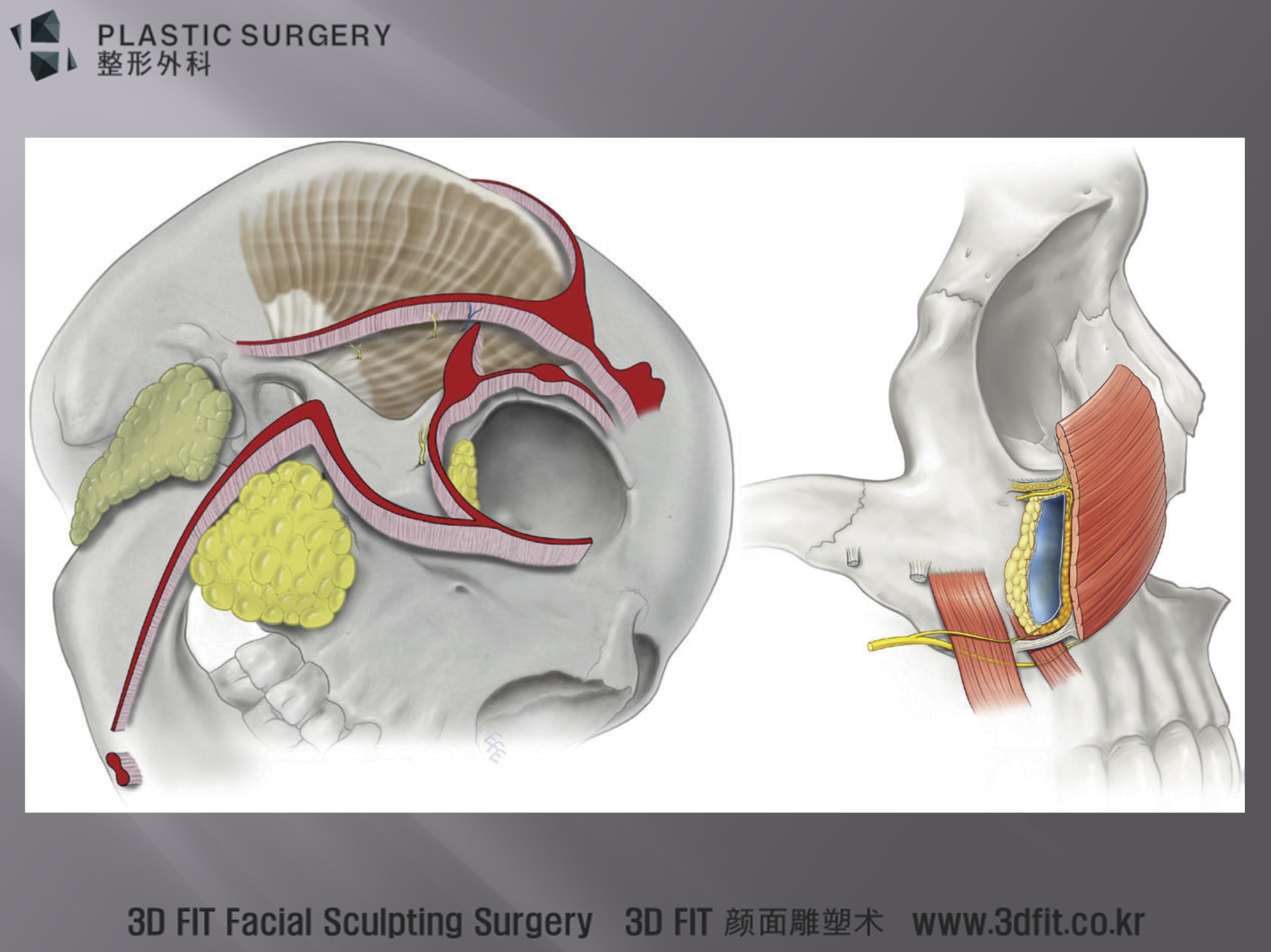 광대뼈 주변과 