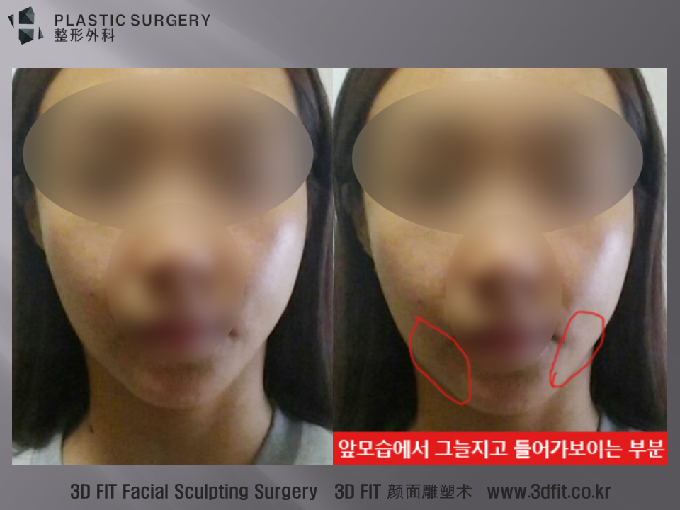 정면에서 보이는 