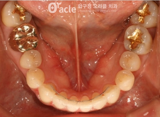 오라클치과 이미지