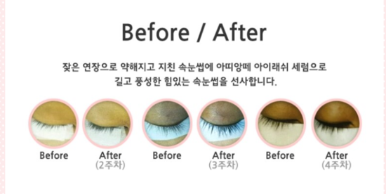 네일아띠 이미지