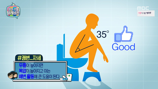 황금똥빵 이미지