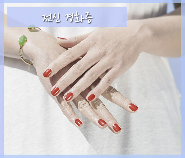 경화반점 이미지