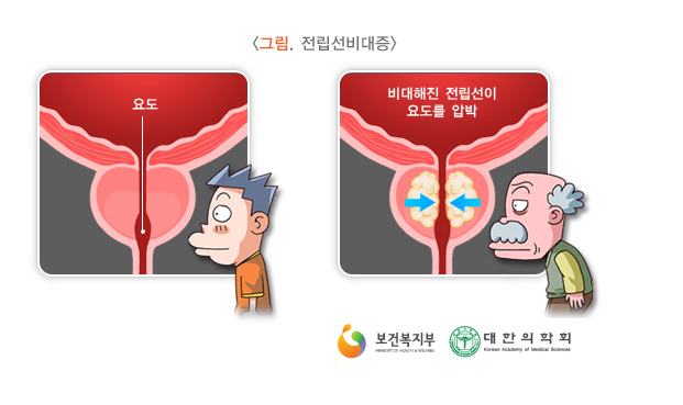 정한수비뇨기과 이미지