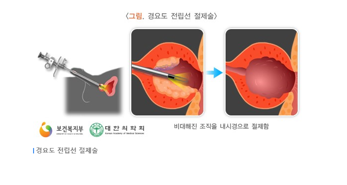 정한수비뇨기과 이미지