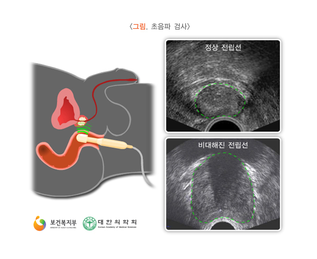 정한수비뇨기과 이미지